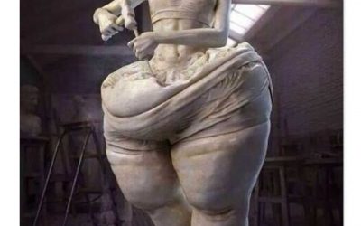 Il lipedema